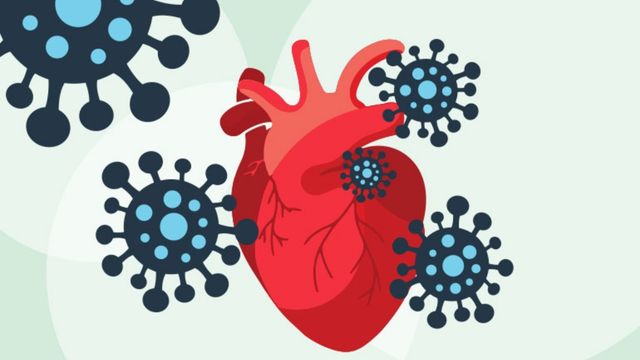 Is COVID-19 bad for your heart A recent study discovered cardiac muscle injury in COVID patients